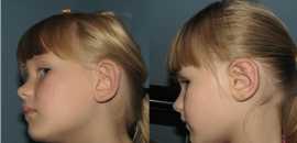 Expert Facial Plastic Surgery Services in Las Alto, Los Altos