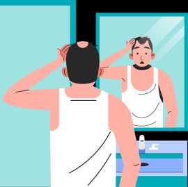 Hair Loss in Men from Hair Fall Treatment Experts, Subiaco