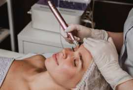Time to Turn Back the Clock: RF Microneedling for , Novena