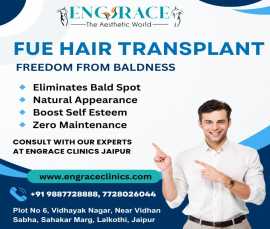 Hair Transplant at Engrace Clinics Jaipur, Jaipur