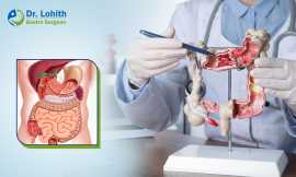 Best Gastroenterologist in Bangalore-Dr. Lohith U, Bengaluru
