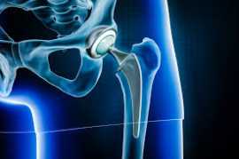 best joint replacement surgeons in Jaipur, Jaipur