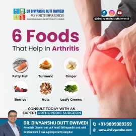 The Power of Food in Joint Pain Relief!, Lucknow