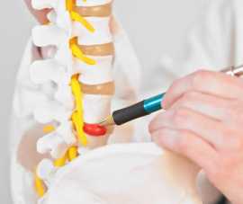 Herniated Disc Lower Back Relief by Mainstay Medic, Artarmon