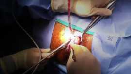 Laser pile’s surgery in kota, Jaipur