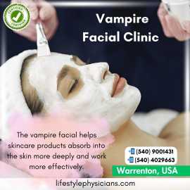 Vampire Facial in Warrenton for Brilliant Skin, Virginia Beach