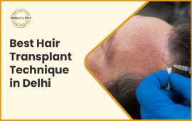 Best Hair Transplant Technique In Delhi, New Delhi