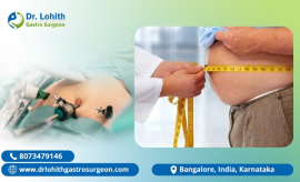 Effective Gastric Bypass surgery in Bangalore, Bengaluru