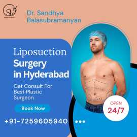 Liposuction Surgery in Hyderabad: Get Safe, Hyderabad