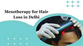 Mesotherapy for Hair Loss in Delhi - Dr. Nandini, New Delhi