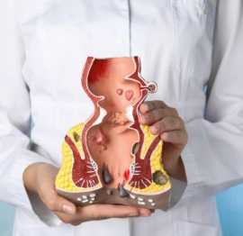 Kshar Sutra Treatment in Lucknow, Lucknow