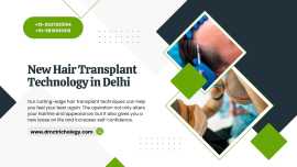 New Hair Transplant Technology In Delhi, New Delhi