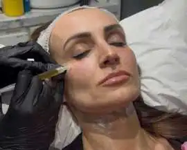 Platelet Rich Plasma Treatment in Kentish Town, London
