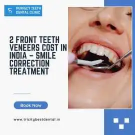 2 Front Teeth Veneers Cost in India, Smile Treatmn, Mohali