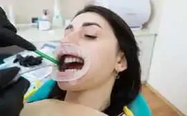 Transform Your Smile: Why Albany Dental Clinic is , Albany
