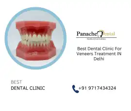 Find Best Dental Clinic For Veneers Treatment IN D, Delhi