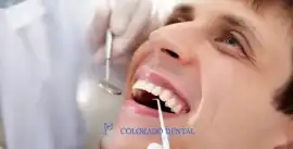 Professional Deep Cleaning for Healthier Gums, Denver