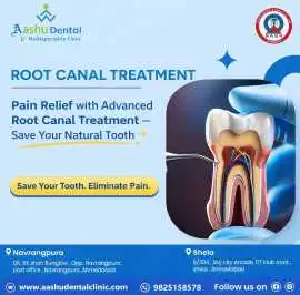India’s Leading Root Canal Treatment, Ahmedabad