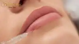 Get Plump Lips with Lip Fillers Riverside, Riverside