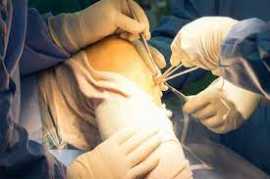 Experienced ACL Ligament Surgery In Dubai, Jaipur