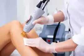 Laser Hair Removal in , Mississauga