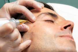 Best Mole Removal Doctors in Jaipur, Jaipur