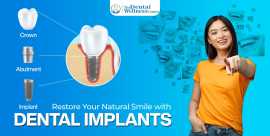 Restore Your Smile with Dental Implants on Dental , Ahmedabad