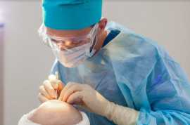Best Hair Transplants Doctor in Jaipur, Jaipur