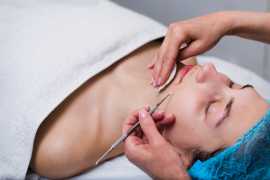 Scar Revision Surgery in San Francisco, San Francisco