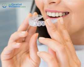 Transparent Orthodontic Devices for Straightening , Ahmedabad