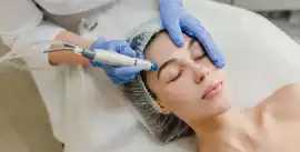 Approaches to Acne Scar Treatment , New Delhi