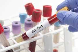 STD Screening at Little Cross Family Clinic, Bukit Timah