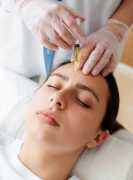 Renuvion J Plasma Skin Resurfacing in San Francisc, San Francisco