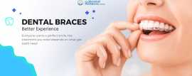 Affordable Dental Braces Cost in Ahmedabad | Denta, Ahmedabad