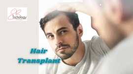 Hair Transplant In Gurgaon at SB Trichology, Haryana