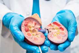 Expert Kidney Stone Removal  at MS Medical, Mumbai