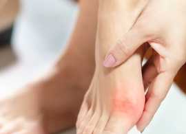 Expert Bunion Specialist in Singapore, Bukit Timah