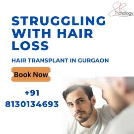 Struggling with Hair Loss? Get a Hair Transplant, Gurgaon