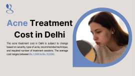 Acne Treatment Cost in Delhi | Mehektagul, New Delhi