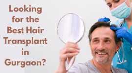 Best Hair Transplant in Gurgaon, Delhi