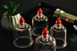 Experience Modern Chinese Cupping in Melbourne, Melbourne