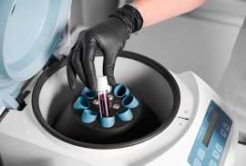 Best Centrifuge for PRP Preparation | Accumaxlab, Ahmedabad