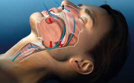 Take Professional Snoring Treatment in Melbourne , Melbourne