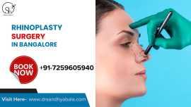  Expert Rhinoplasty Surgery in Bangalore, Bengaluru