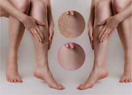 what kind of doctor treats veins, Lindenhurst