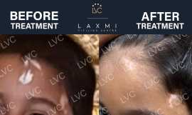 Best Doctor & Best Homeopathic Vitiligo Treatm, Madurai