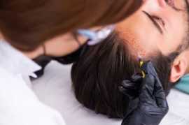 Best Hair Restoration Services in Gorakhpur, Lucknow