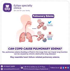Best Pulmonology Clinic Kondapur - Ezitaa Clinics, Hyderabad