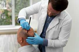 Best Hair Transplant Cost in Kanpur , Lucknow