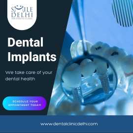 Discover the Future of Smiles: Dental Implants, Delhi